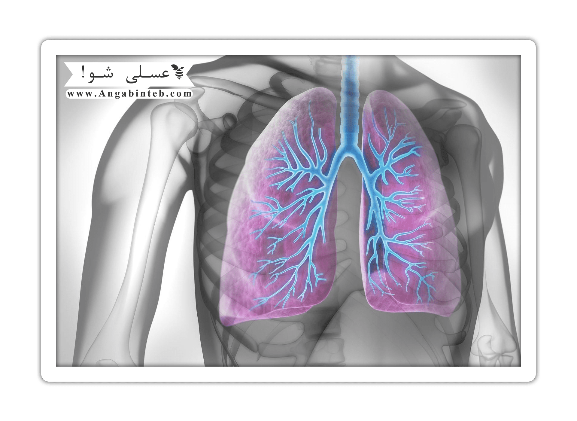 Respiratory distress syndrome-cure-min.png